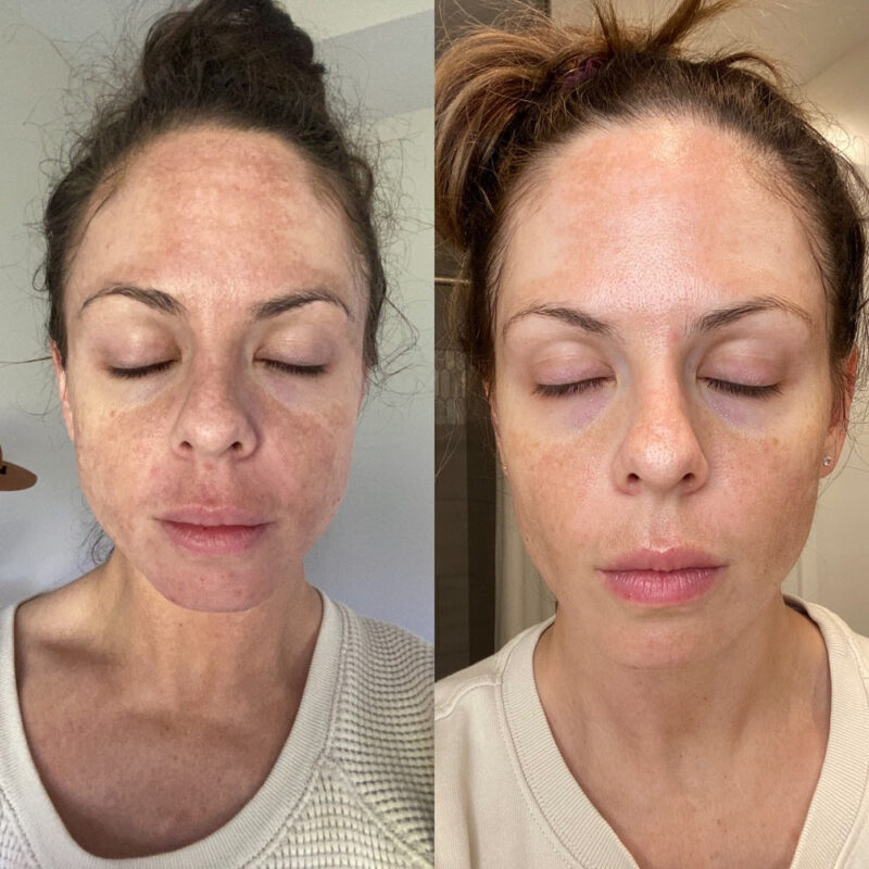 Ksbridal Advanced Skin Brightening Kit - Image 2