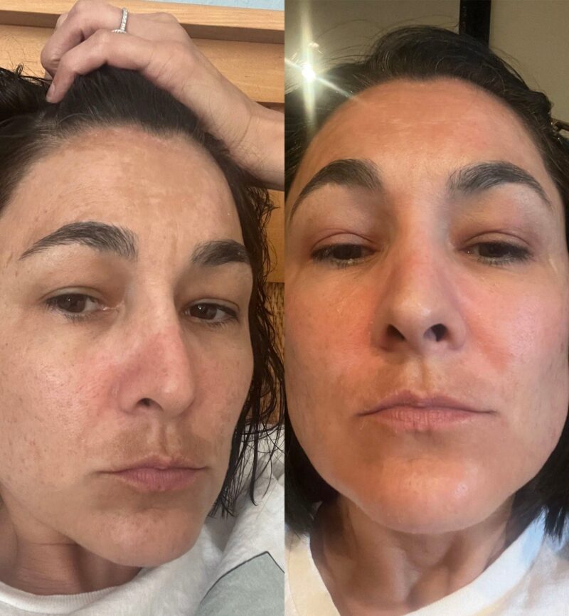 Ksbridal Advanced Skin Brightening Kit - Image 8