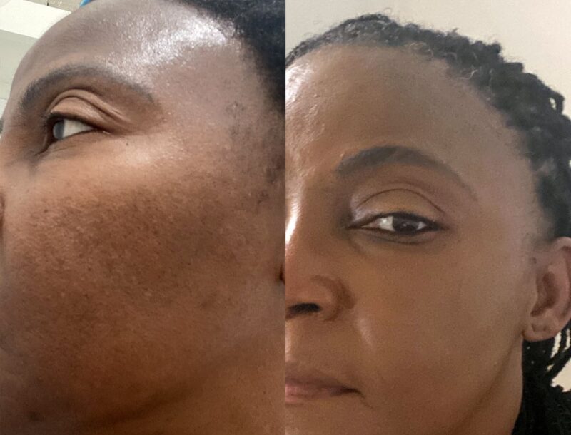 Ksbridal Advanced Skin Brightening Kit - Image 9